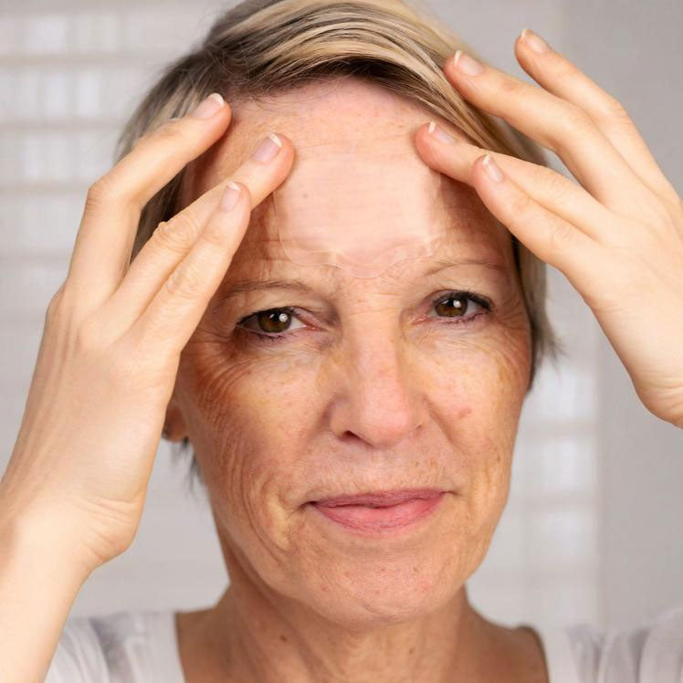 Microneedle Forehead Patches - Hyaluronic Acid Treatment for Fine Lines & Wrinkles