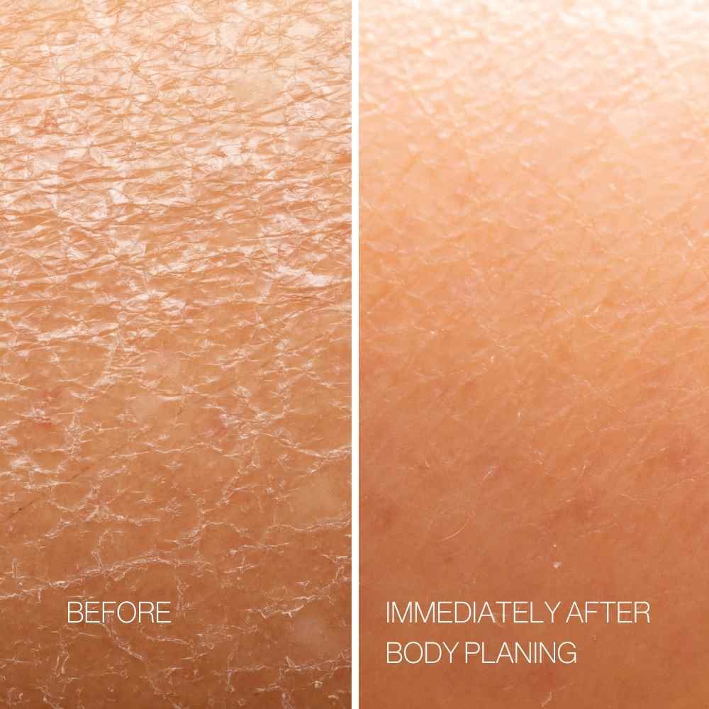Body Plane Set - Exfoliating Tool + Body Oil Gift Set