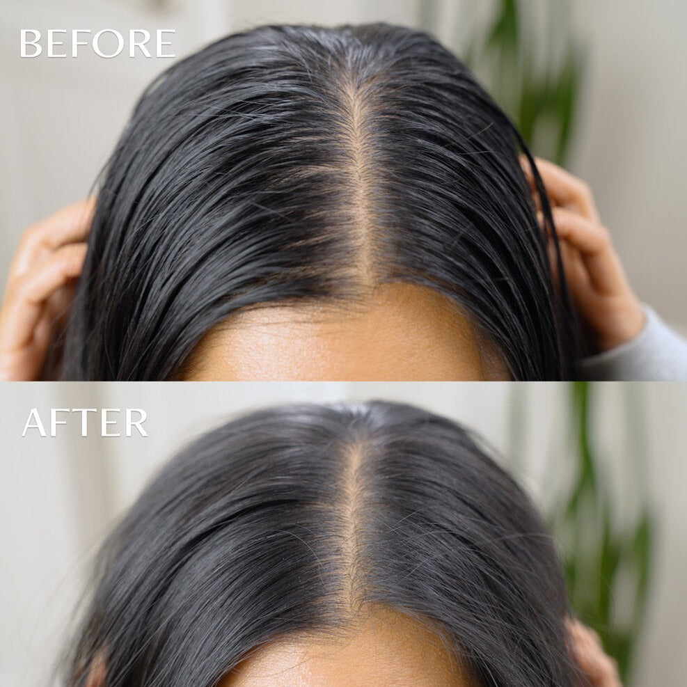 Double Day After™ Brush + Refills Bundle - Dry Shampoo Powder System